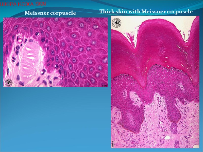 Meissner corpuscle Thick skin with Meissner corpuscle ШКІРА КОЖА SKIN